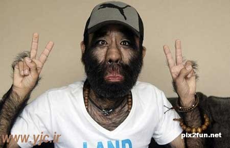 بد شانس‌ترین انسان‌های دنیا+عکس